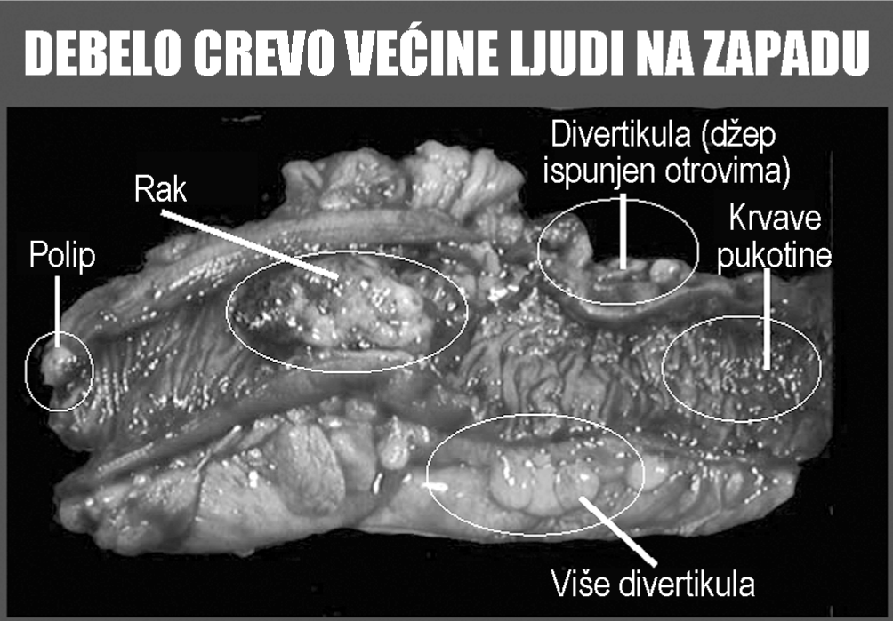 prirodna medicina